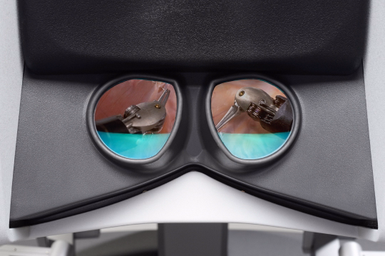 Image-of-viewers-on-surgeon-console